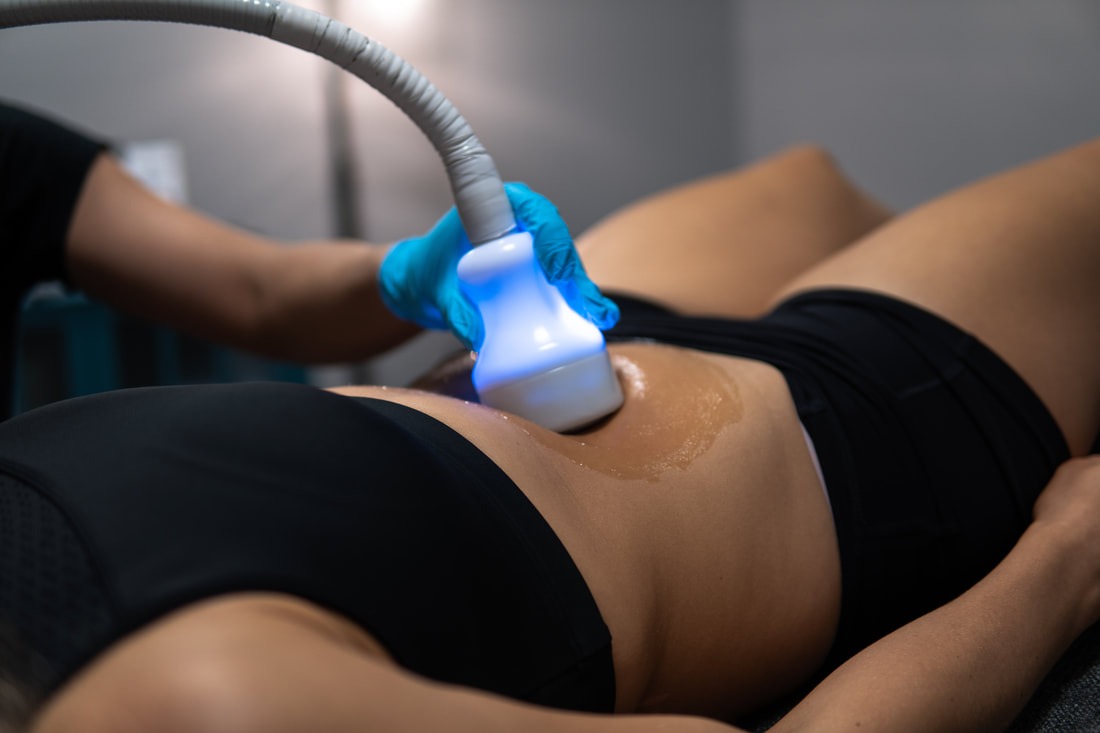 Cryo Toning Nedir?