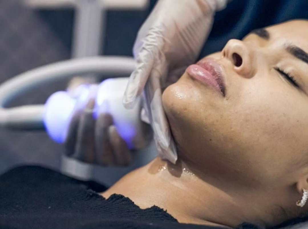 CryoFacial